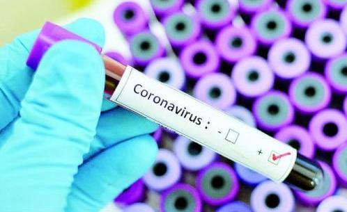 Число заразившихся коронавирусом в Армении - 249, один пациент в крайне тяжелом состоянии - «Политика»