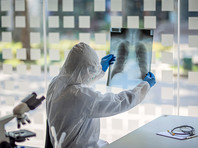 Итальянские врачи назвали болезни, повышающие риск умереть при коронавирусе - «В мире»