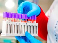 Москва закупит тесты на коронавирус за 192 млн рублей у фирм без телефона и медицинской лицензии - «Россия»