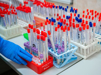 Со вторника в Москве начнут проверять на антитела к CОVID-19 - «Россия»