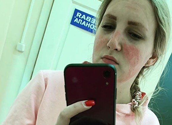 Во Владимирской области медсестра получила ожог лица после использования маски - «Новости дня»