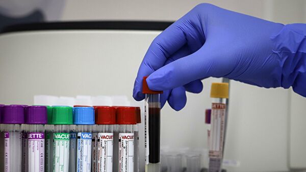 Минздрав рассказал об используемых в медучреждениях тестах на COVID-19 - «Медицина»