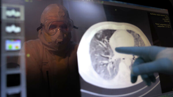 В Минздраве заявили о способности коронавируса поражать любые органы - «Медицина»