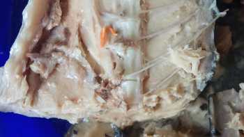 Живые черви в рыбных консервах: так помог Департамент образования малоимущим семьям - «Новости дня»