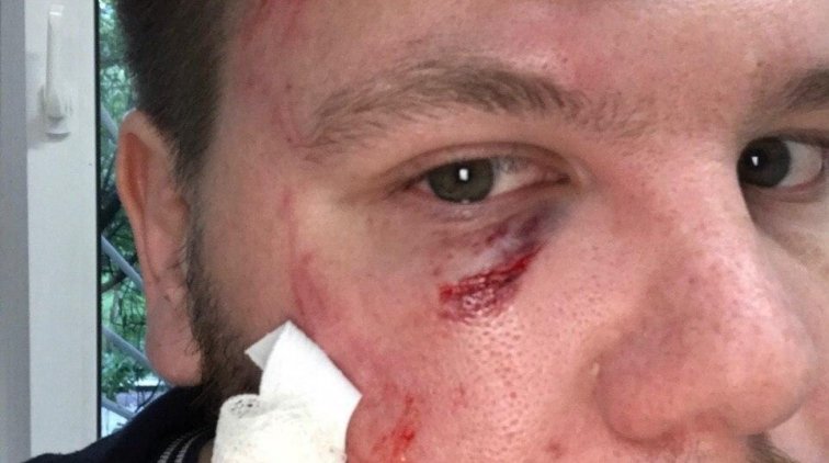 В Петербурге сторонники Путина избили активистов за листовки против «обнуления» сроков - «Новости дня»