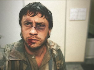 Прилучный показал разбитое лицо после обвинений в насилии - «Культура»
