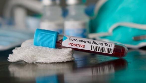 В Арцахе коронавирус подтвердился еще у 6 граждан - «Политика»