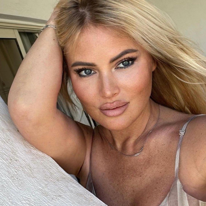 Дана Борисова рассказала, как прошла её последняя пластическая операция