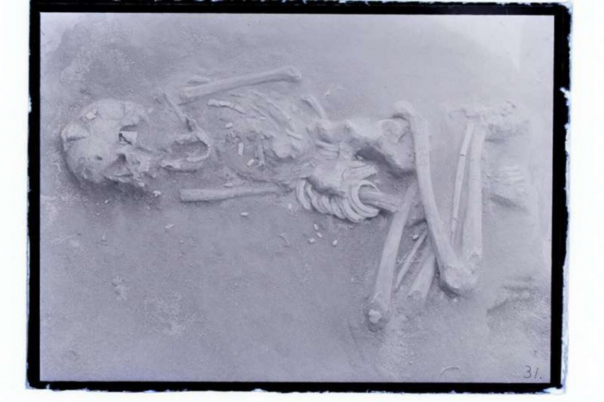 PLOS ONE: раскрытие древней японской практики модификации черепа