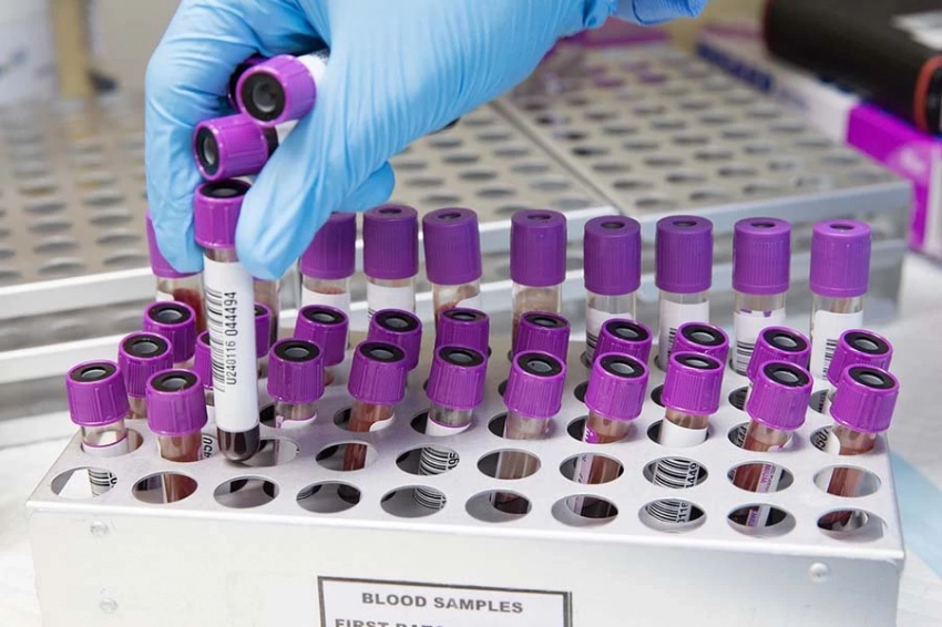 Названа группа крови, обладатели которой живут дольше других