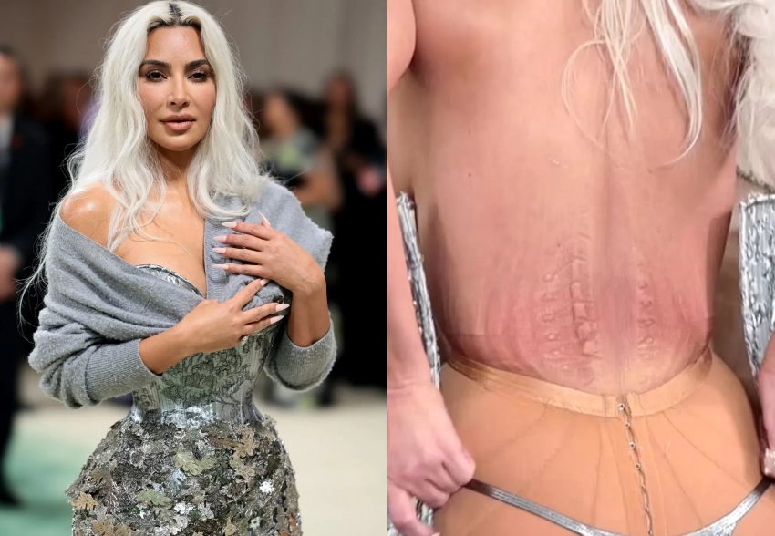 "Я никогда не испытывала такой боли". Ким Кардашьян показала следы от экстремального корсета, за который её раскритиковали в сети